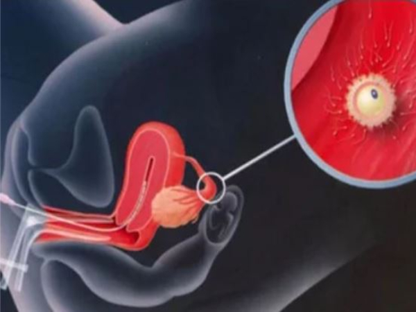 IVF Doctor in Jaipur